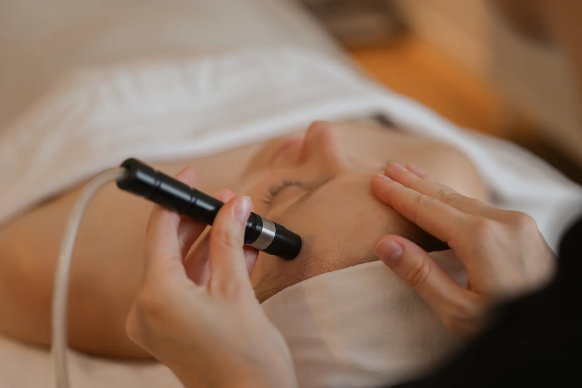 Specialist voert een BellaPeel-behandeling uit