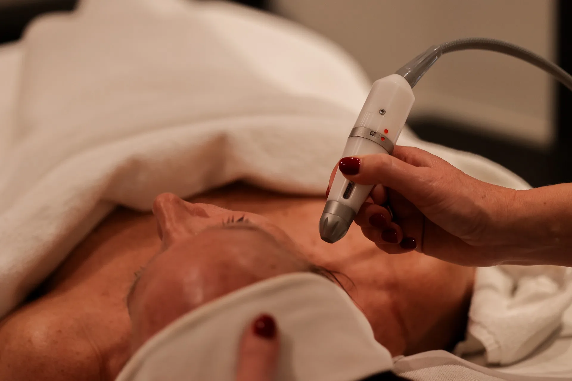 CliΓ«nt tijdens een BellaPeel-gezichtsbehandeling